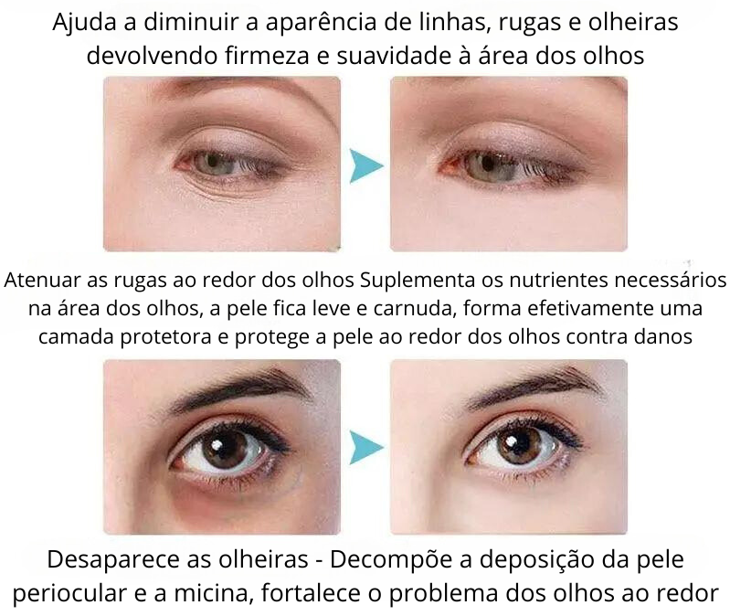 Creme Para os Olhos Com Retinol Ativo